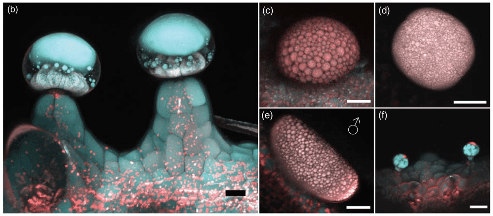 fluorescence of different trichomes from Finola