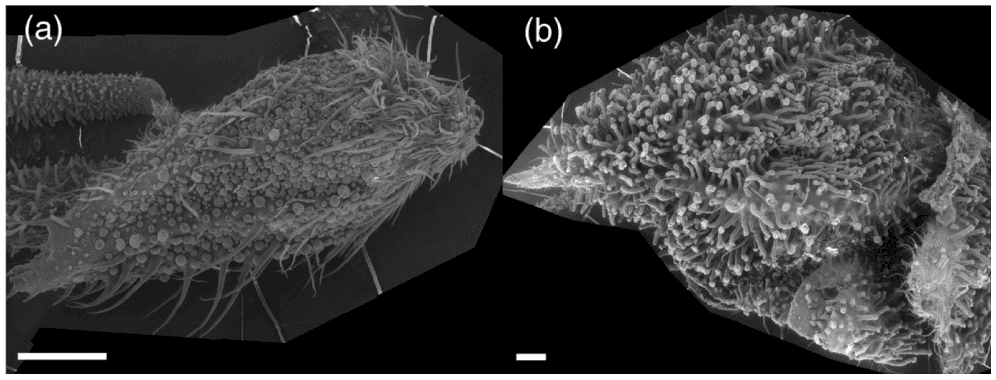 calyx of female flower in different stages